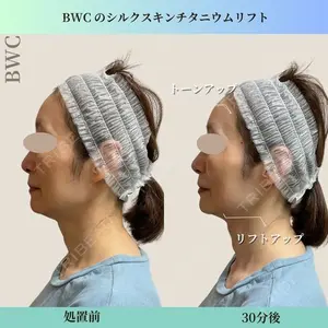ビューティー和心クリニック 浅草院の症例
