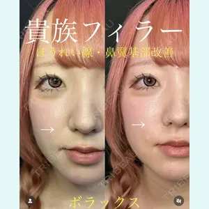 症例
