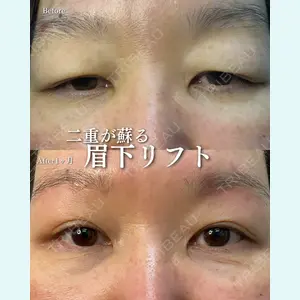 ルラ美容クリニック 渋谷本院 住友 沙織医師の症例