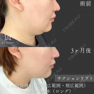 ziz CLINIC 村岡 史子医師の症例