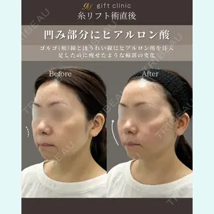 gift clinic 能登谷 翔医師の症例