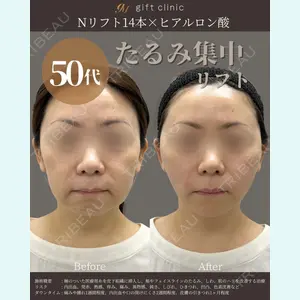 gift clinic 能登谷 翔医師の症例
