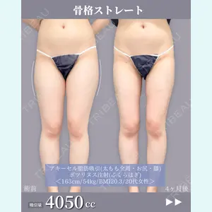東京シンデレラ美容外科 新宿院 吉原 伯医師の症例