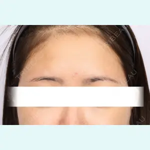 More ＆ More Clinic ホ・ヤンフェ医師の症例