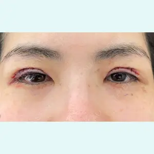 お茶の水美容形成クリニック 吉井 健吾医師の症例