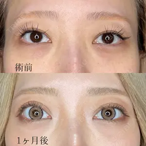 症例