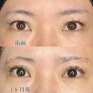 症例