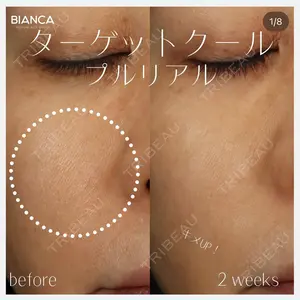 BIANCA銀座 池田 雪太郎医師の症例