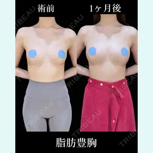 症例