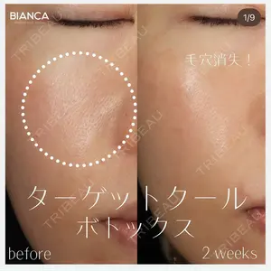 BIANCA銀座 池田 雪太郎医師の症例