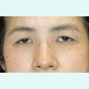 お茶の水美容形成クリニック 吉井 健吾医師の症例