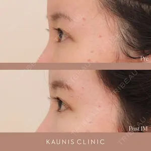 KAUNIS CLINIC（カウニスクリニック） 高野 敏郎医師の症例
