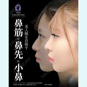 東京シンデレラ美容外科 新宿院 吉原 伯医師の症例