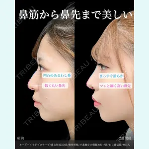 東京シンデレラ美容外科 新宿院 吉原 伯医師の症例