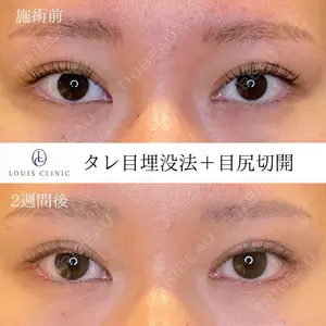 LOUIS CLINIC 二子玉川院【ルイクリニック】 小松 塁医師の症例