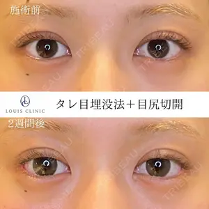 LOUIS CLINIC 二子玉川院【ルイクリニック】 小松 塁医師の症例
