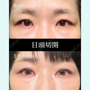 症例