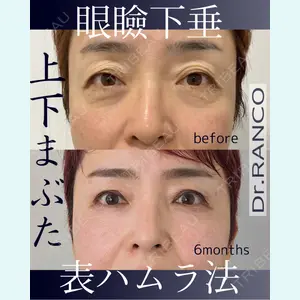 オーキッド美容クリニック東京御徒町 西浦 蘭子医師の症例