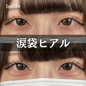 ルラ美容クリニック 新宿院の症例