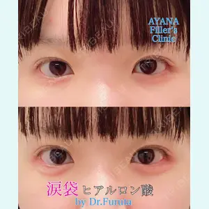 症例