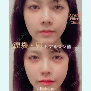 症例