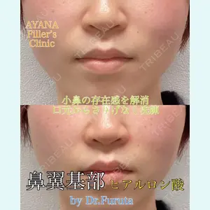 症例