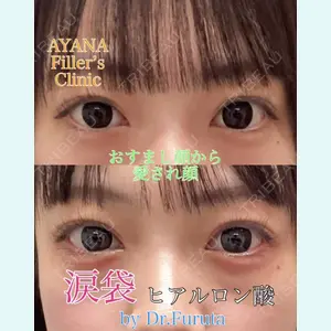 症例