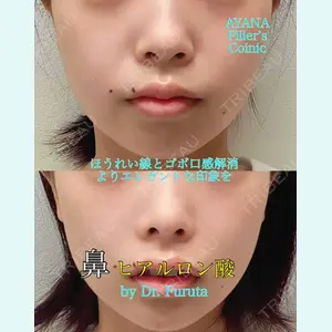 症例