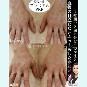 聖心美容クリニック 熱海院 小林 美幸（皮膚科）医師の症例
