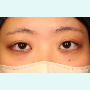 聖心美容クリニック 大宮院 伊藤 哲郎医師の症例