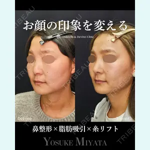 シンデレラ＆ダヴィンチクリニック 宮田 洋佑医師の症例