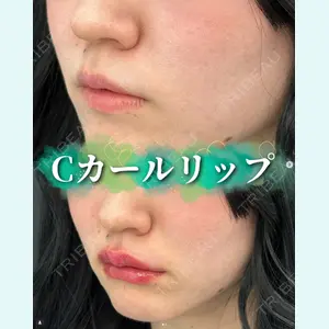 症例