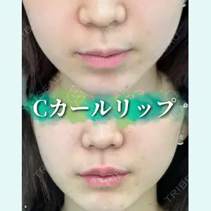 症例