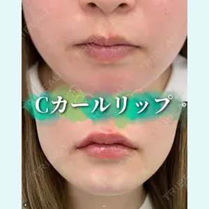 症例