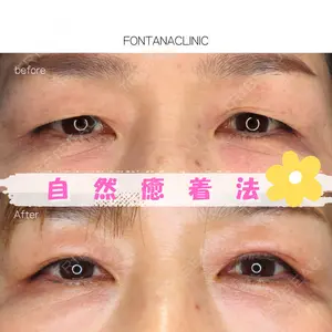 フォンタナクリニック天神 松本 かな子医師の症例