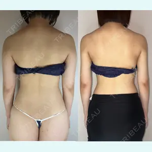 GAYA body design clinic 飯ヶ谷 重来医師の症例