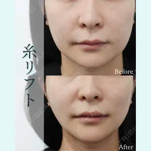 L‘amour clinic Tokyo【ラムールクリニック東京】の症例