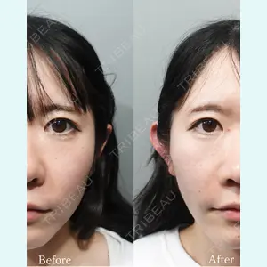 L‘amour clinic Tokyo【ラムールクリニック東京】の症例