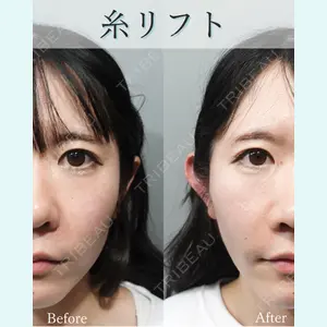 L‘amour clinic Tokyo【ラムールクリニック東京】の症例
