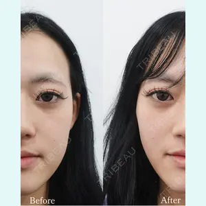 L‘amour clinic Tokyo【ラムールクリニック東京】の症例
