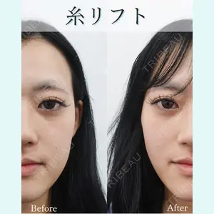L‘amour clinic Tokyo【ラムールクリニック東京】の症例