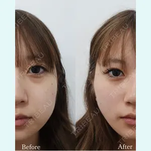 L‘amour clinic Tokyo【ラムールクリニック東京】の症例