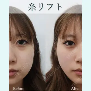 L‘amour clinic Tokyo【ラムールクリニック東京】の症例