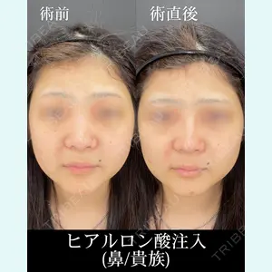 HAAB×DREAM BEAUTY CLINIC 大阪梅田院 錦 実奈医師の症例