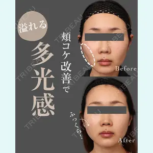 THE CLINIC（ザ・クリニック） 東京院 帯包 雄次郎医師の症例