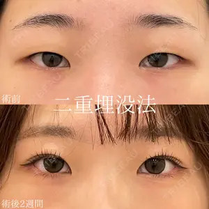 オアシス美容外科 遠藤 剛史医師の症例