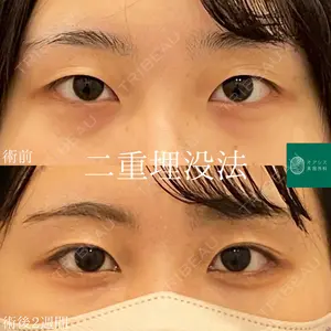 オアシス美容外科の症例