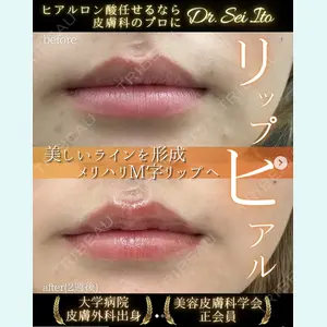 症例
