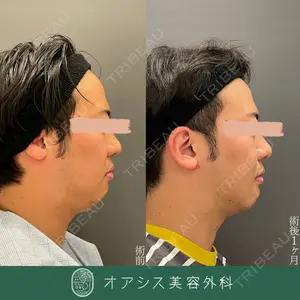 オアシス美容外科 遠藤 剛史医師の症例
