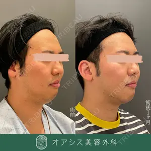 オアシス美容外科 遠藤 剛史医師の症例